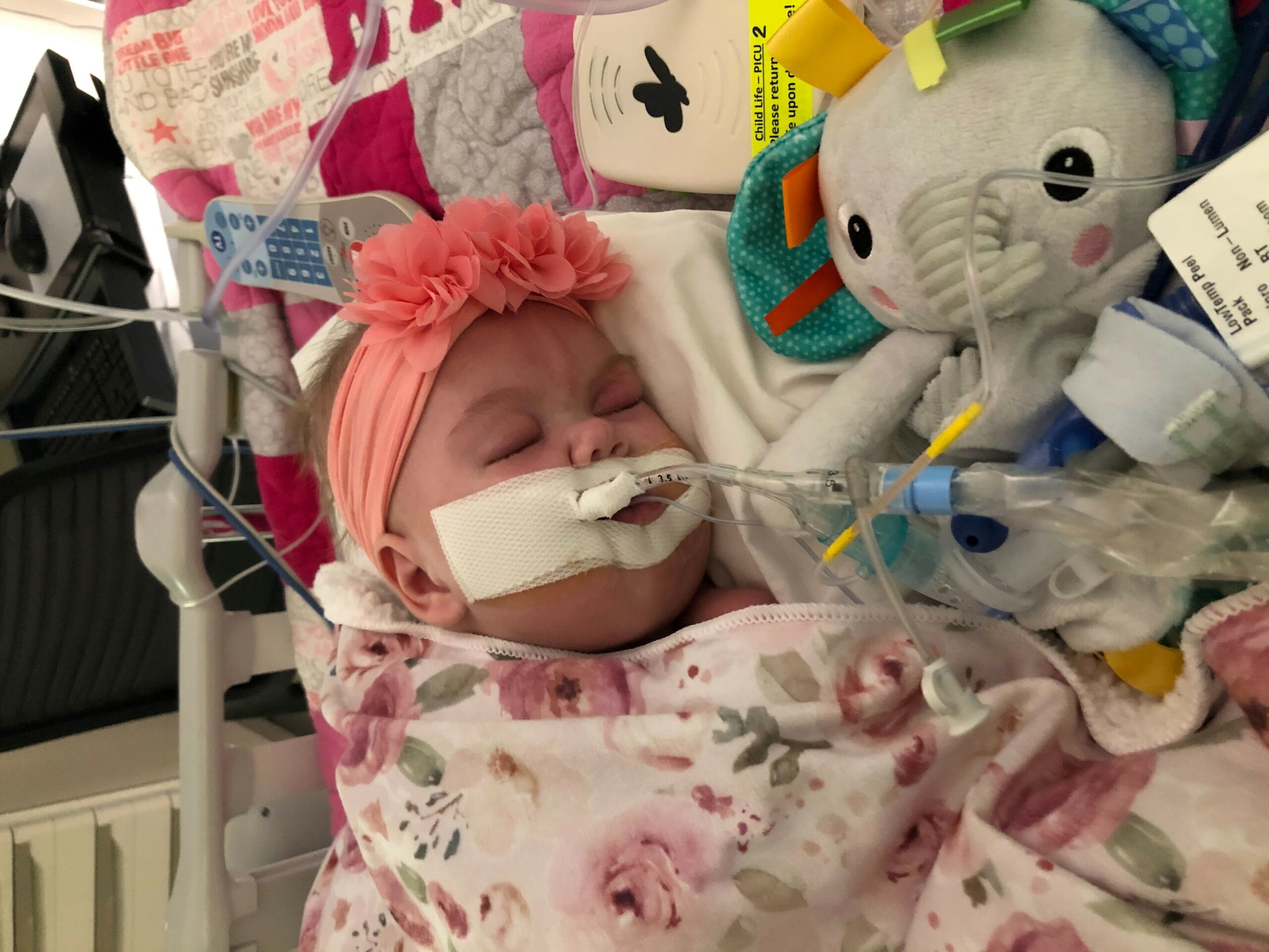 Newborn Emery hooked up to a ventilator